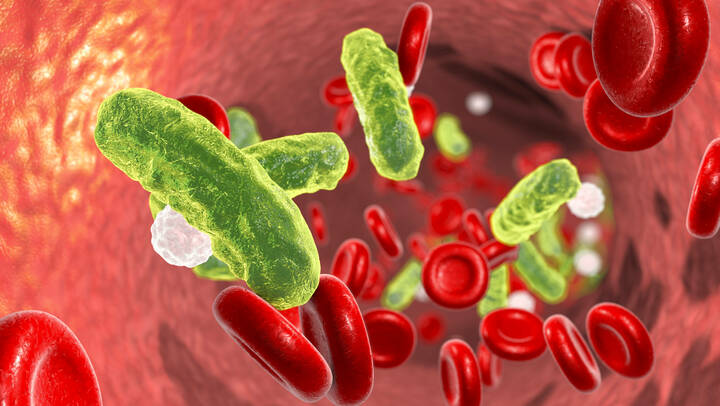 Internationaler Tag der Händehygiene nimmt Sepsis ins Visier