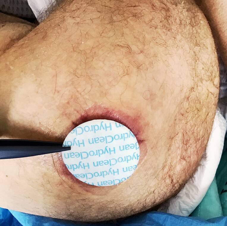 Nichtmedikamentöse Alternativen nutzen