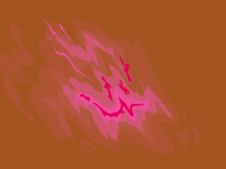 Skin Tears sind häufige Hautverletzungen, besonders bei älteren Menschen. Ursachen, Risikofaktoren, Prävention und moderne Therapie im Überblick.