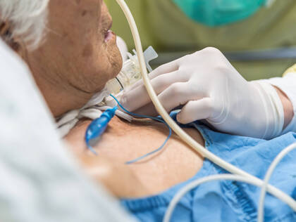 Die "Above Cuff Vocalisation" (ACV) ermöglicht Intensivpatienten mit geblockter Trachealkanüle temporär das Sprechen. Durch gezielte Luftzufuhr verbessert sie Kommunikation, Lebensqualität und Sekretmanagement – bei korrekter Indikation und Anwendung.