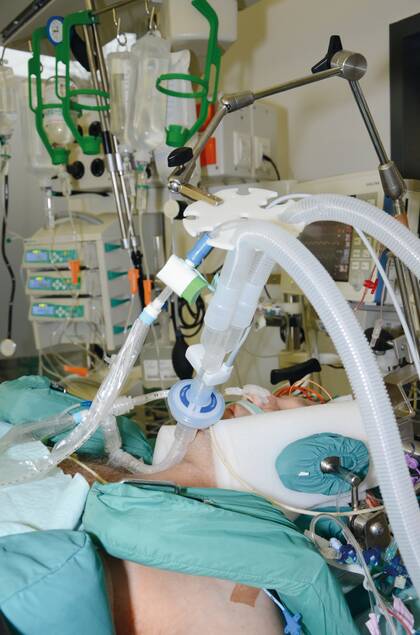 Polytrauma: Überlebenschancen weiter verbessern