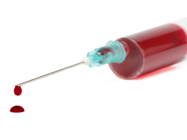 Patient Blood Management - Jeder Tropfen zählt