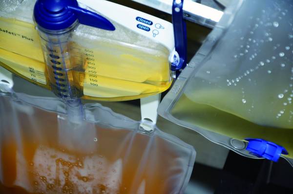 Urinbeutel Wechseln Video