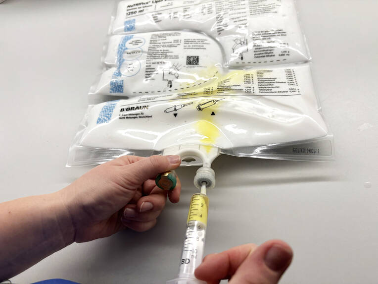 Sicher ernähren per Infusion