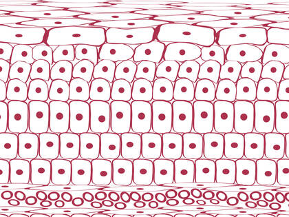 Eine längere und/oder wiederholte Exposition der Haut gegenüber Urin und/oder Stuhl kann zu einer Inkontinenz-assoziierten Dermatitis führen. Unser Autor fasst den aktuellen Forschungsstand zusammen. 