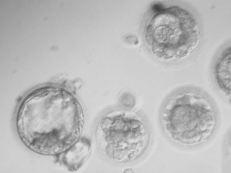 Eine aktuelle Leitlinie beschäftigt sich mit unerwünschten Begleiterscheinungen im Rahmen der in der Onkologie eingesetzten Immuntherapie.