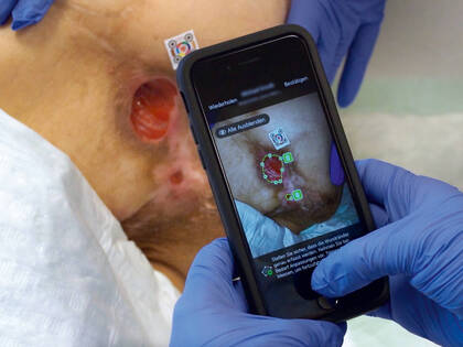 Das Universitätsklinikum Gießen setzt auf eine neue App für Wunddokumentation: einfache, schnelle und objektive Erfassung inklusive Fotos – dank geplanter Implementierung.