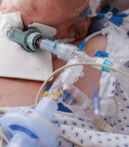 Infektionsrisiko Intensivstation