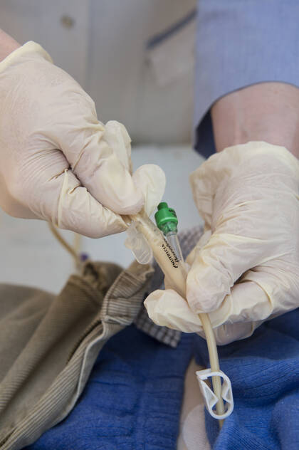 Ein Forscherteam hat den Nutzen und die Sicherheit von Nasen- und PEG-Sonden in einem Cochrane-Review miteinander verglichen.