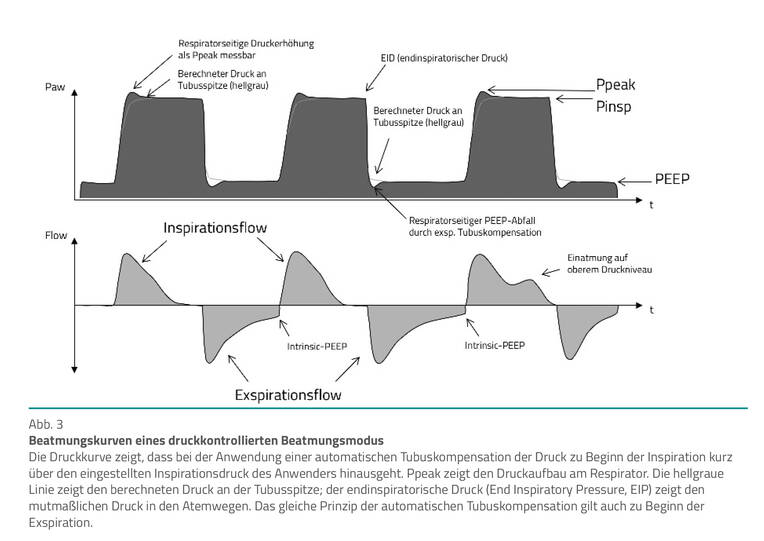 Einstellparameter kennen – Beatmungskurven interpretieren