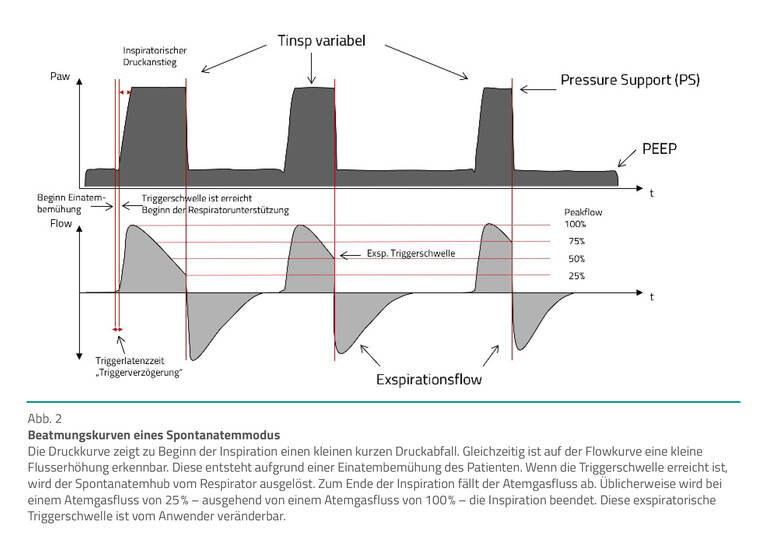 Einstellparameter kennen – Beatmungskurven interpretieren