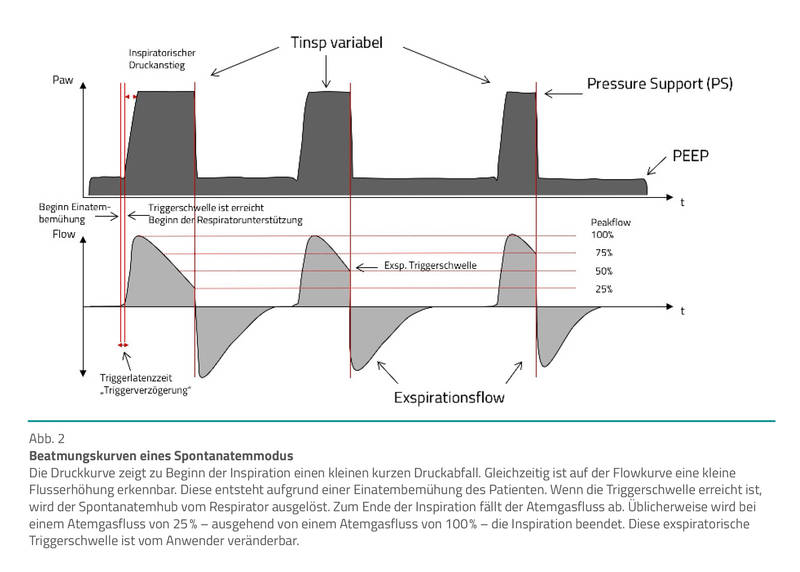 Patienten mit Beatmung Einstellparameter kennen Beatmungskurven