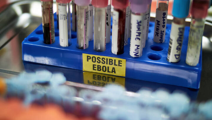 Ebola-Ausbruch in Afrika: 75 Pflegekräfte infiziert. Schlechter Schutz und atypische Symptome erschweren die Eindämmung, warnt die WHO.