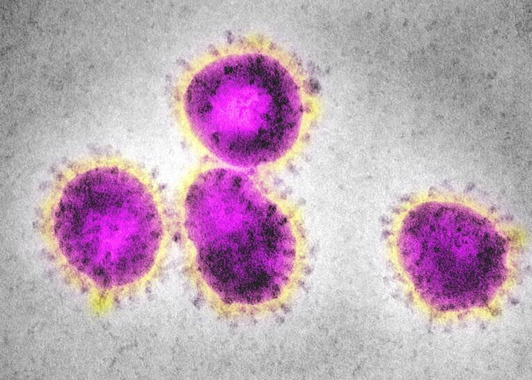 Das neuartige Coronavirus breitet sich weltweit rasant aus. Betroffene Patienten sind als hochinfektiös anzusehen. 