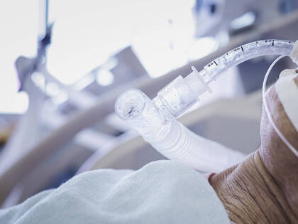 Einer Studie zufolge stirbt mehr als jeder zehnte beatmete Patient. Eine Analyse der Studienergebnisse und möglicher Gründe der Krankenhausmortalität.