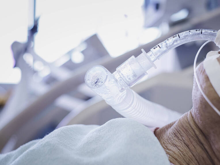 Einer Studie zufolge stirbt mehr als jeder zehnte beatmete Patient. Eine Analyse der Studienergebnisse und möglicher Gründe der Krankenhausmortalität.