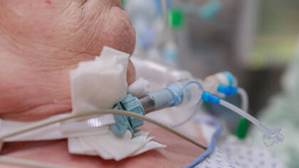 Eine Forschungsgruppe untersuchte Prädiktoren für ein Weaningversagen bei beatmeten Intensivpatienten.