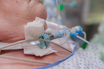 Neue G-BA-Regel: Ab Juli 2025 entfällt für viele Patienten die Pflicht zur Potenzialerhebung – wichtig für Pflegende in der außerklinischen Intensivpflege. Neue G-BA-Regel: Ab Juli 2025 entfällt für viele Patienten die Pflicht zur Potenzialerhebung – wichtig für Pflegende in der außerklinischen Intensivpflege.