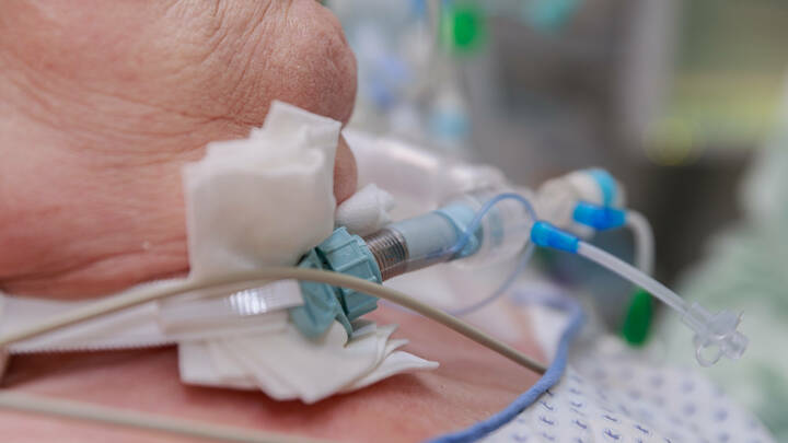 FDP, Grüne und Linke fordern Spahn auf, seine Reformvorschläge für die Reha- und Intensivpflege erneut zu ändern.