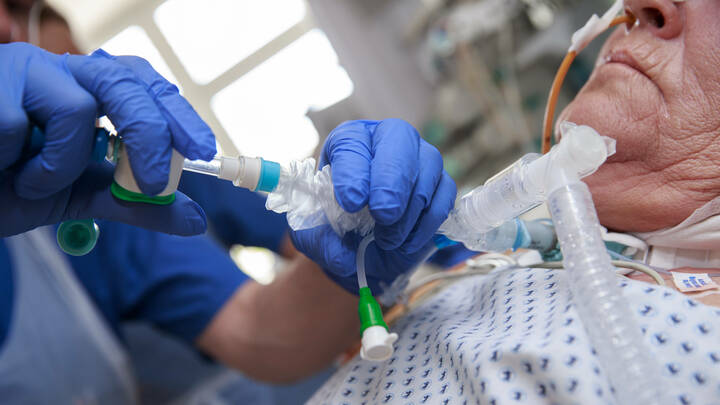 Bundesgesundheitsminister Spahn will Geschäfte auf Kosten schwerkranker Menschen in der außerklinischen Intensivpflege unterbinden. 