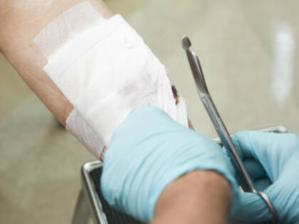 Welche Wundauflagen wirken am besten bei Dekubitus?