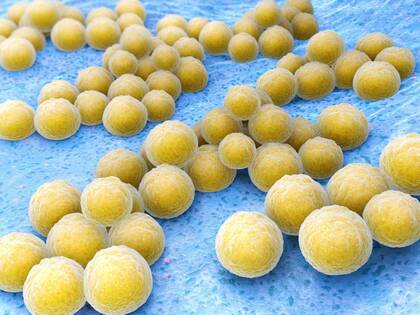 Multiresistente Erreger wirksam eindämmen