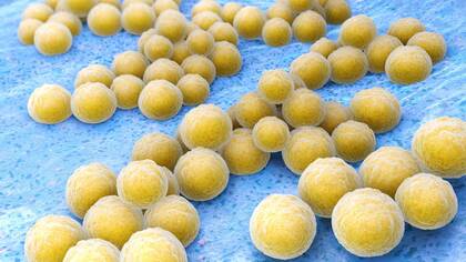 2019 starben in Deutschland laut RKI und IHME rund 45.700 Menschen im Zusammenhang mit antibiotikaresistenten Infektionen.  2019 starben in Deutschland laut RKI und IHME rund 45.700 Menschen im Zusammenhang mit antibiotikaresistenten Infektionen.