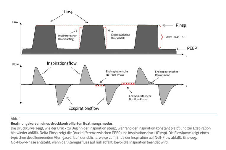 Einstellparameter kennen – Beatmungskurven interpretieren