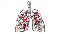 Pneumonieprophylaxe zwischen Evidenz und Praxis