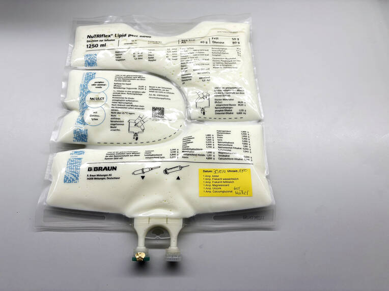 Sicher ernähren per Infusion