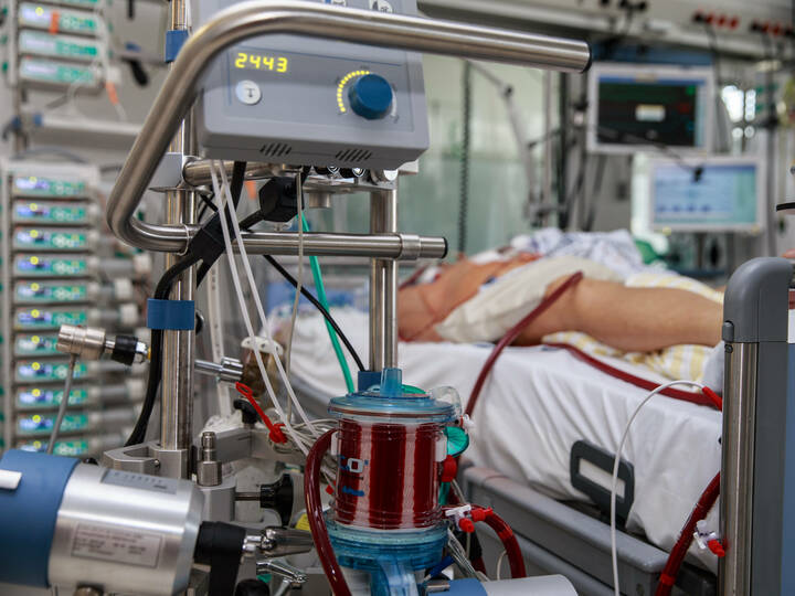 Nach Intensivtherapie: Viele Patienten leiden unter chronischen Schmerzen