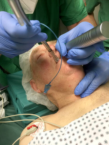 Erweiterte Maßnahmen im Überblick