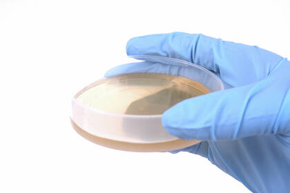 Für 2023 ist ein deutlicher Anstieg gramnegativer Krankenhauserreger festgestellt worden. Das hat Folgen auf verfügbare Therapieoptionen. 