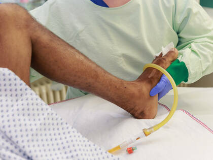 Was bringt Frühmobilisierung? 