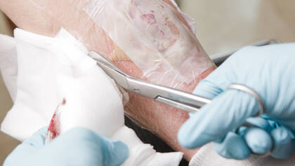 Wie sieht die haftungsrechtliche Situation aus, wenn ein Dekubitus eine Klage nach sich zieht?