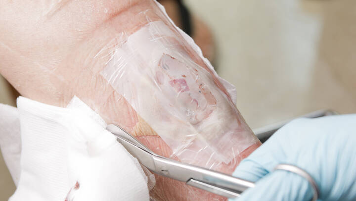 Das DNQP aktualisiert den Expertenstandard zur Dekubitusprophylaxe und sucht Experten für die Mitarbeit. Bewerbungsschluss ist der 11. März 2026.