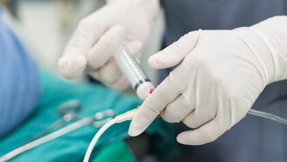 Anstelle von Inhalationsanästhetika nutzt die Anästhesiologie des Uniklinikums Erlangen für Vollnarkosen standardmäßig das intravenöse Propofol.  Anstelle von Inhalationsanästhetika nutzt die Anästhesiologie des Uniklinikums Erlangen für Vollnarkosen standardmäßig das intravenöse Propofol.