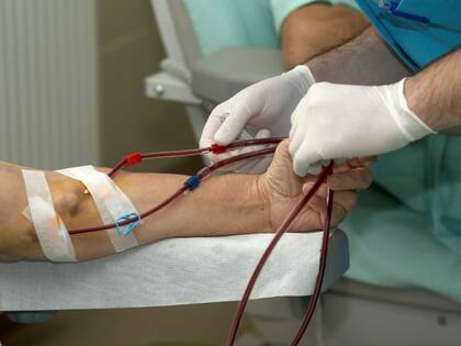 Kälte reduziert Schmerzen bei Shunt-Punktion