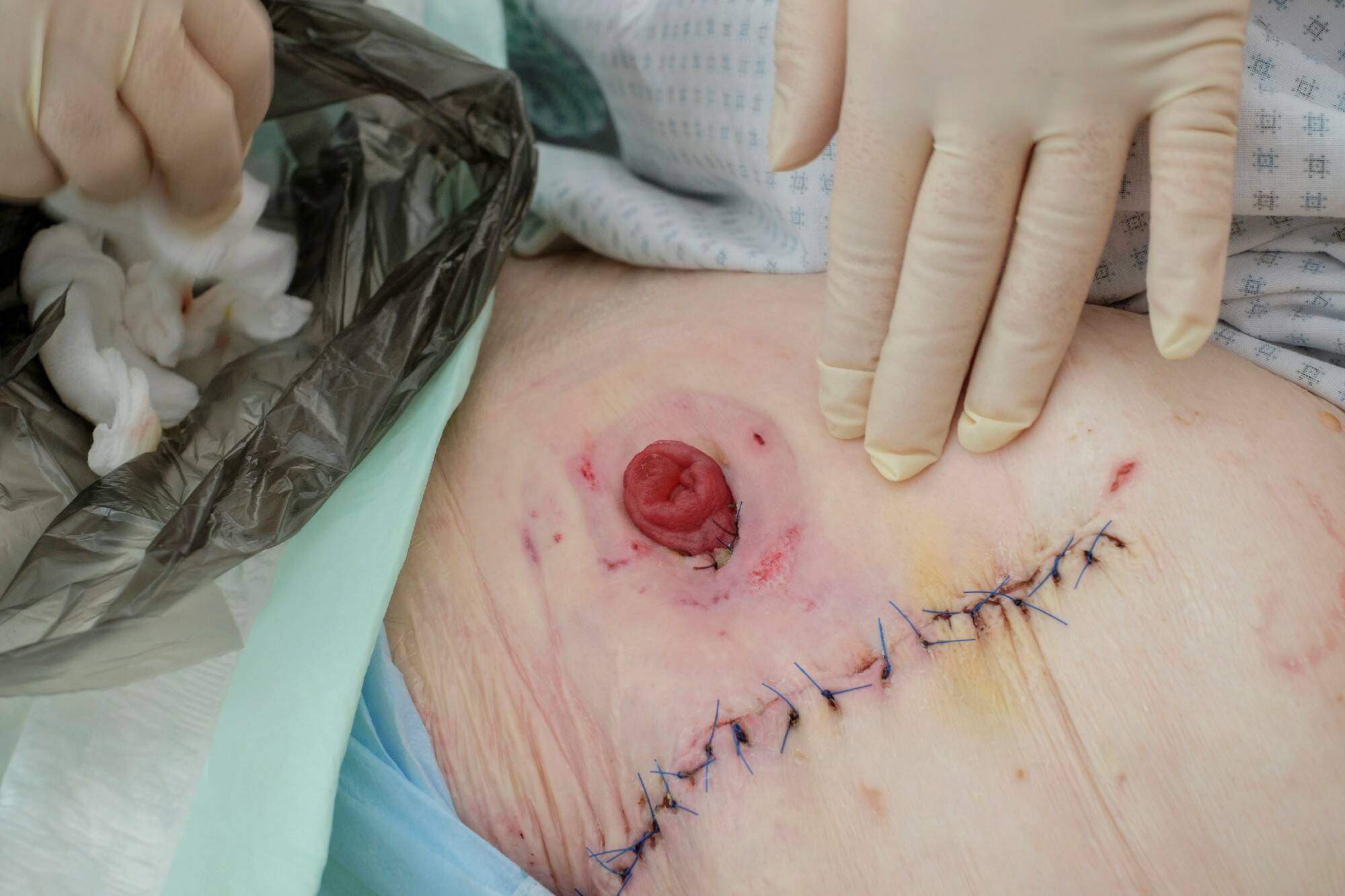 Von außen nach innen oder von innen nach außen?