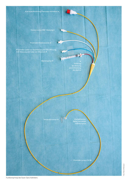 Präzise Daten rund ums Herz