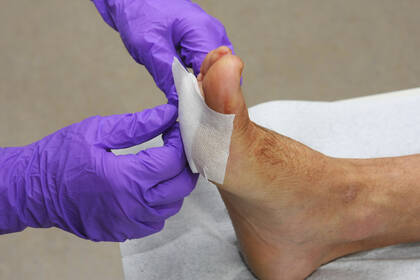 Können Verbände und topische Mittel wie Cremes, Lotionen und Öle tatsächlich wirksam Dekubiti bei Risikopersonen verhindern? Können Verbände und topische Mittel wie Cremes, Lotionen und Öle tatsächlich wirksam Dekubiti bei Risikopersonen verhindern?