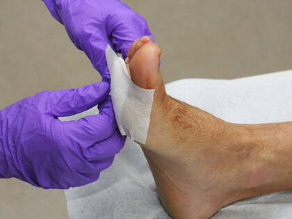 Welchen Nutzen haben antimikrobielle Verbände?