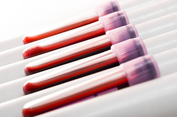 Zum Welt-Sepsis-Tag fordern DGAI und BDA eine bessere Früherkennung und Versorgung. Ein neues Qualitätssicherungsverfahren startet 2026 in deutschen Kliniken.