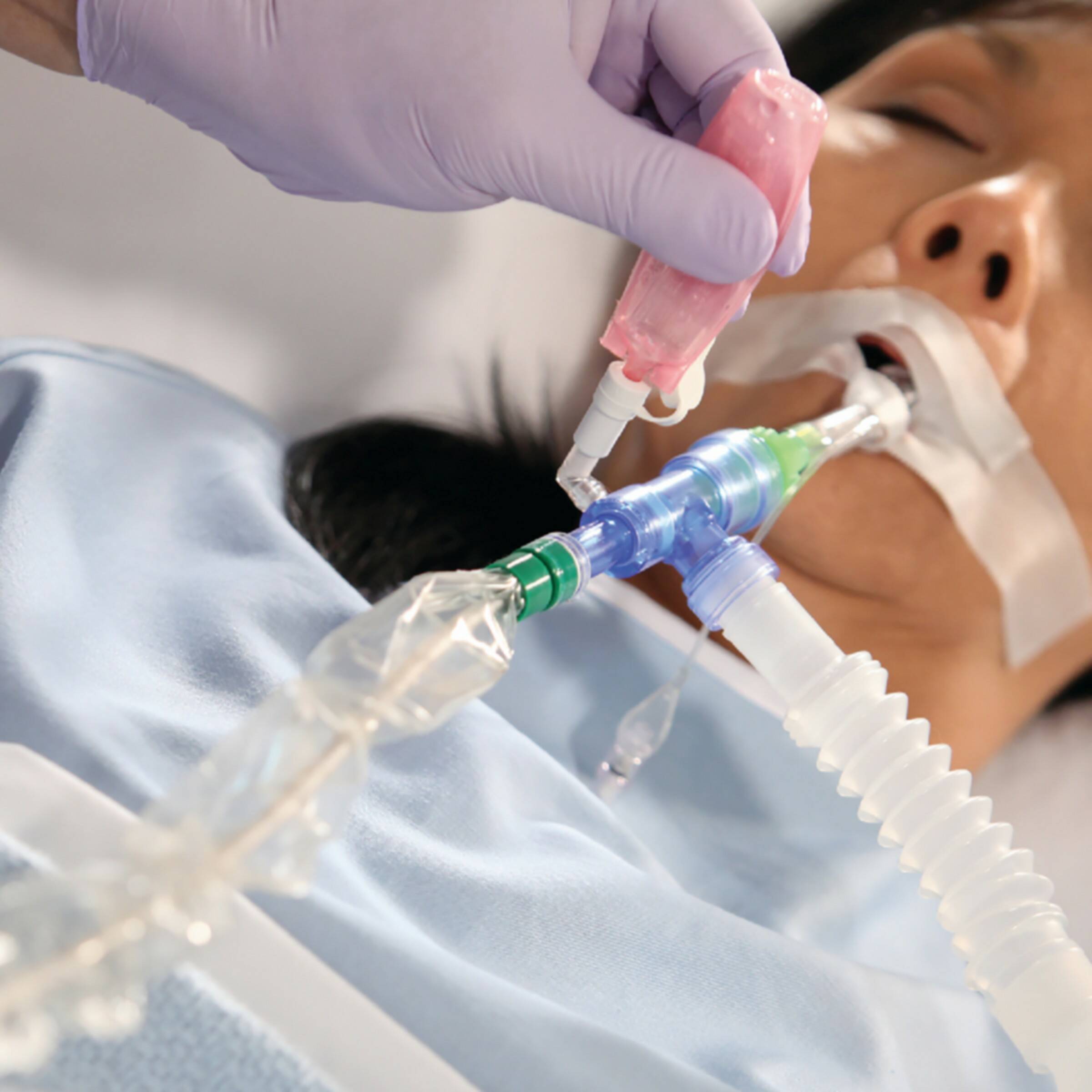 Endotracheales Absaugen: Invasiver Eingriff mit Risiken
