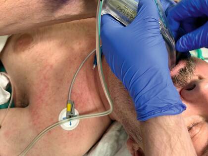 Modernes Atemwegsmanagement