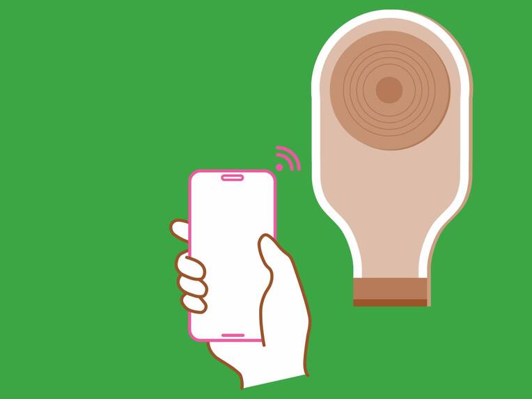 Hautschäden und Leckagen belasten Menschen mit Enterostoma stark. Innovative Lösungen wie Sensoren und 3D-Modelle verbessern Versorgung und Lebensqualität.