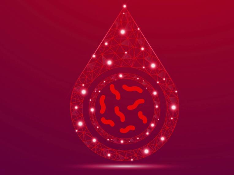 Die neue S3-Leitlinie zur Sepsis legt besonderen Fokus auf die Früherkennung. Pflegefachpersonen spielen dabei eine zentrale Rolle – insbesondere bei der Anwendung geeigneter Einschätzungsinstrumente. Die neue S3-Leitlinie zur Sepsis legt besonderen Fokus auf die Früherkennung. Pflegefachpersonen spielen dabei eine zentrale Rolle – insbesondere bei der Anwendung geeigneter Einschätzungsinstrumente.