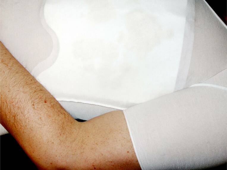 Die aktualisierte S3-Leitlinie "Palliativmedizin für Patienten mit einer nicht heilbaren Krebserkrankung" widmet sich u. a. den Versorgungsoptionen von Menschen mit malignen Wunden. 