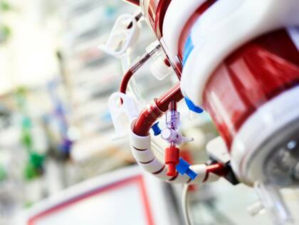 Mit Lars Krüger sprachen wir über die Schwerpunkte in der Pflege von Patientinnen und Patienten mit extrakorporalen Therapien.