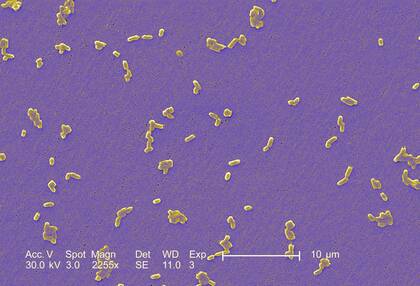 Sepsis evidenzbasiert behandeln